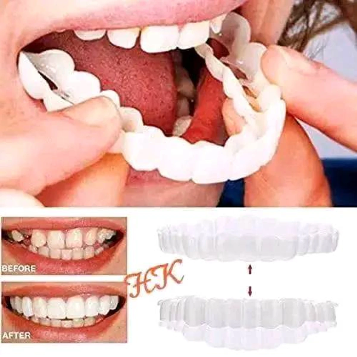 1 pair ( 2 pcs ) Snap on smile teeth veneers